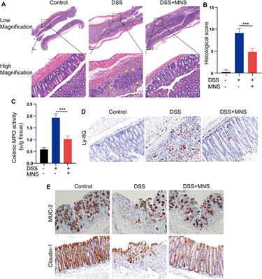 3,4-Methylenedioxy-β-Nitrostyrene Alleviates Dextran Sulfate Sodium–Induced Mouse Colitis by Inhibiting the NLRP3 Inflammasome